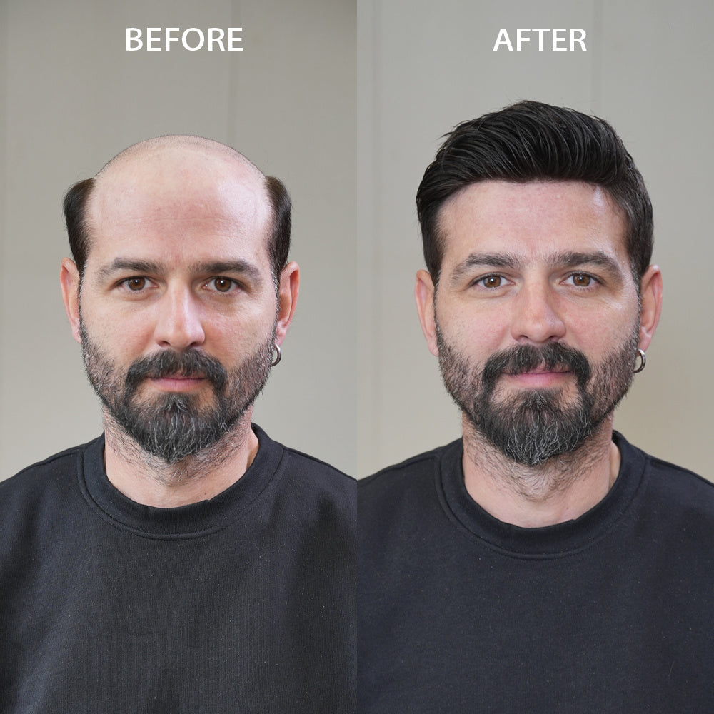 How to Measure Head Size for Men's Hair Replacement System