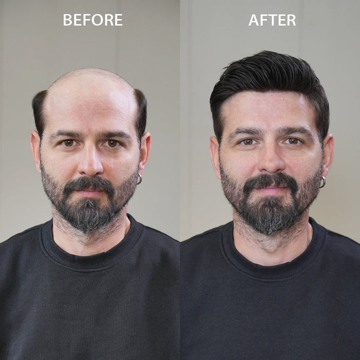 How to Measure Head Size for Men's Hair Replacement System
