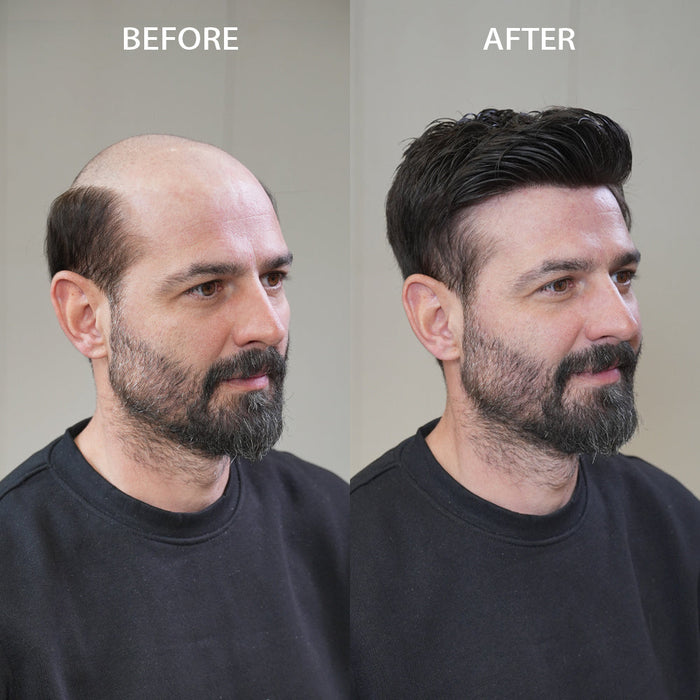 How Do Hair Systems Look So Natural Today?