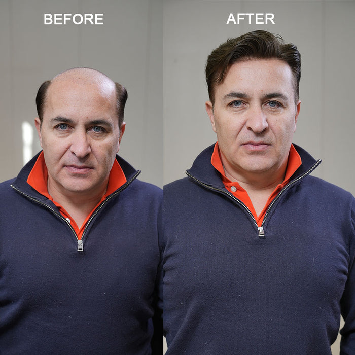 LYRICAL TOUPEE Custom Men's Hair System