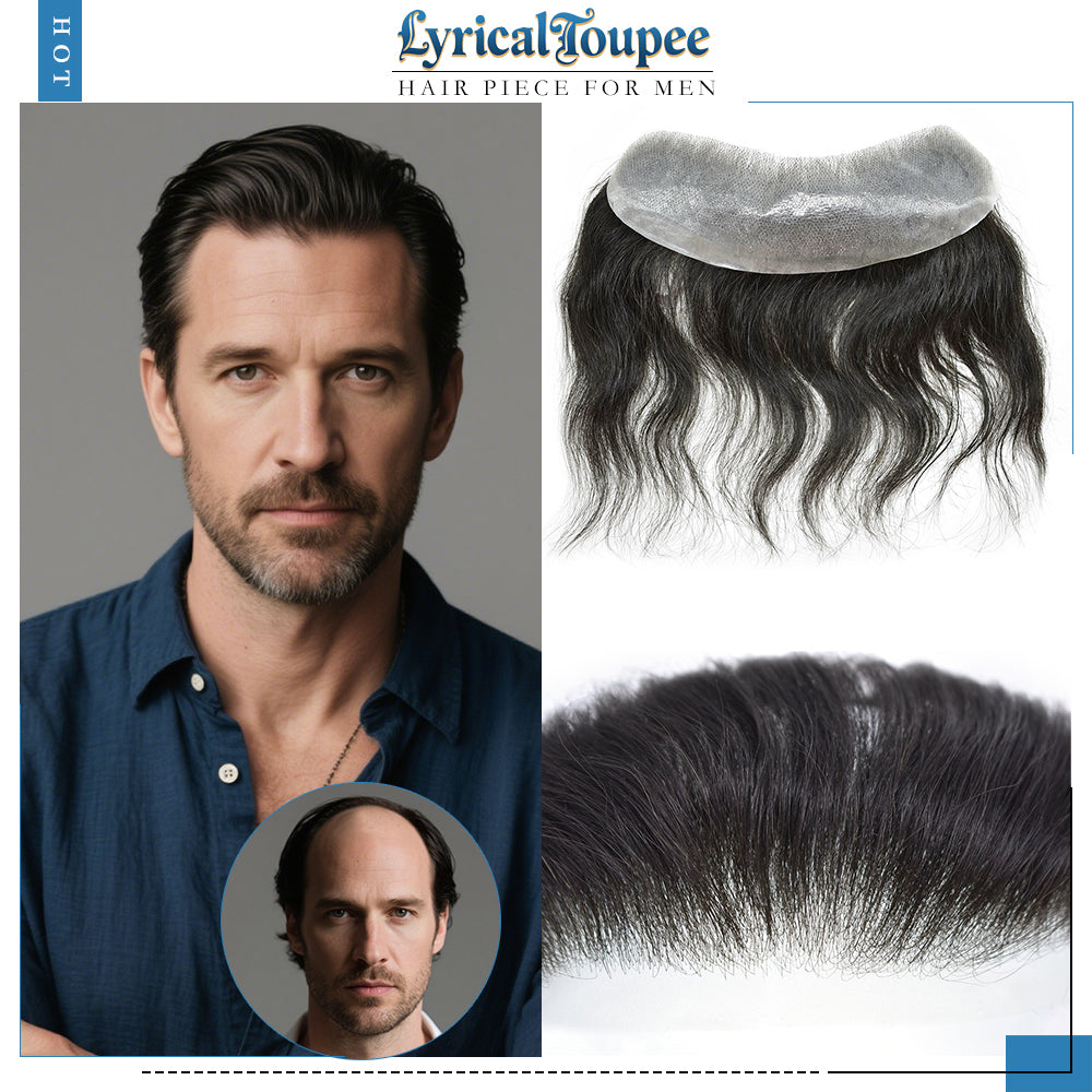 Frontal Hair Systems