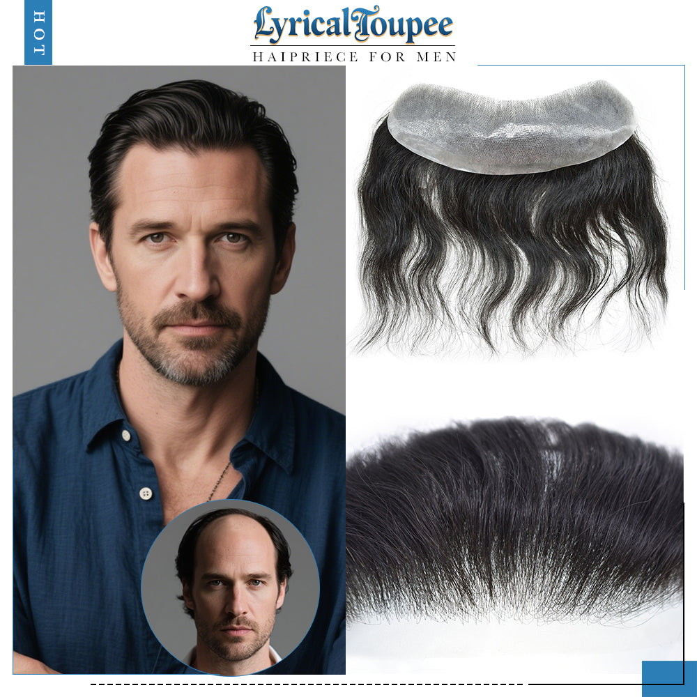 Frontal Hair System